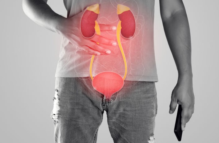 Understanding Bladder Cancer: Symptoms, Causes, and Treatments