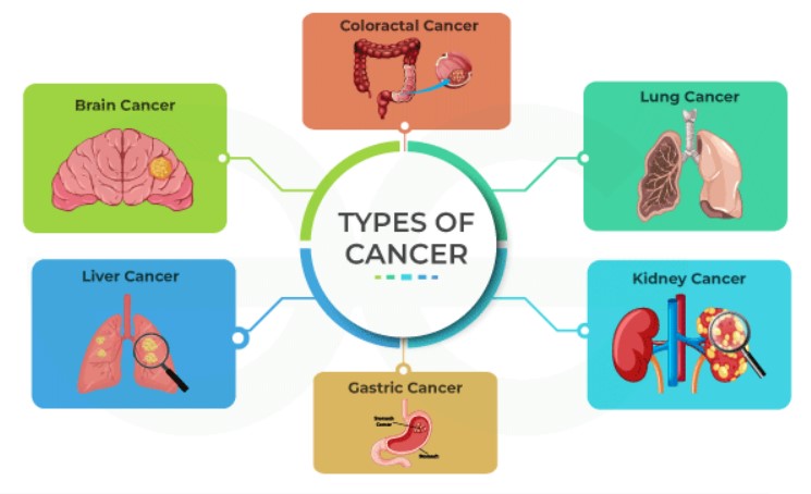 Understanding the Different Types of Cancer