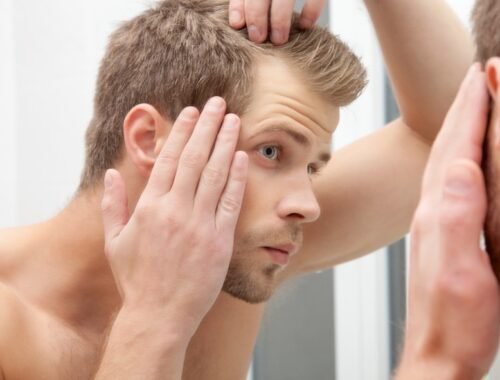 Finasteride and Male Hair Loss - What Actually Happens When Men Start Taking It