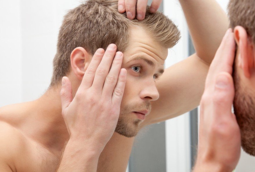 Finasteride and Male Hair Loss - What Actually Happens When Men Start Taking It